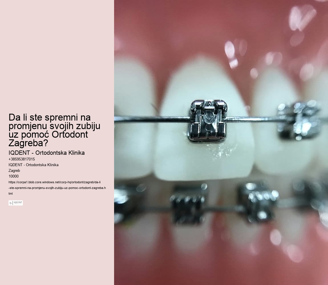 Da li ste spremni na promjenu svojih zubiju uz pomoć Ortodont Zagreba? 