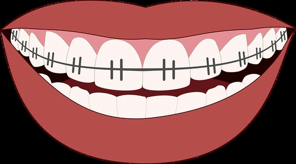 Unaprijeđene metode čišćenja usne šupljine tijekom trajanja terapija 
